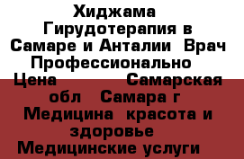 Хиджама. Гирудотерапия в Самаре и Анталии. Врач. Профессионально. › Цена ­ 2 500 - Самарская обл., Самара г. Медицина, красота и здоровье » Медицинские услуги   